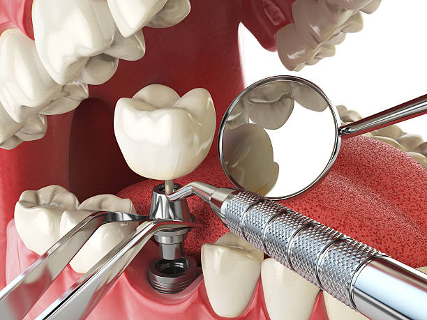Best Emergency Wisdom Teeth Removal in Massanetta Springs, VA